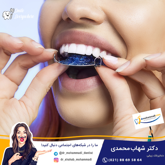 ارتودنسی متحرک